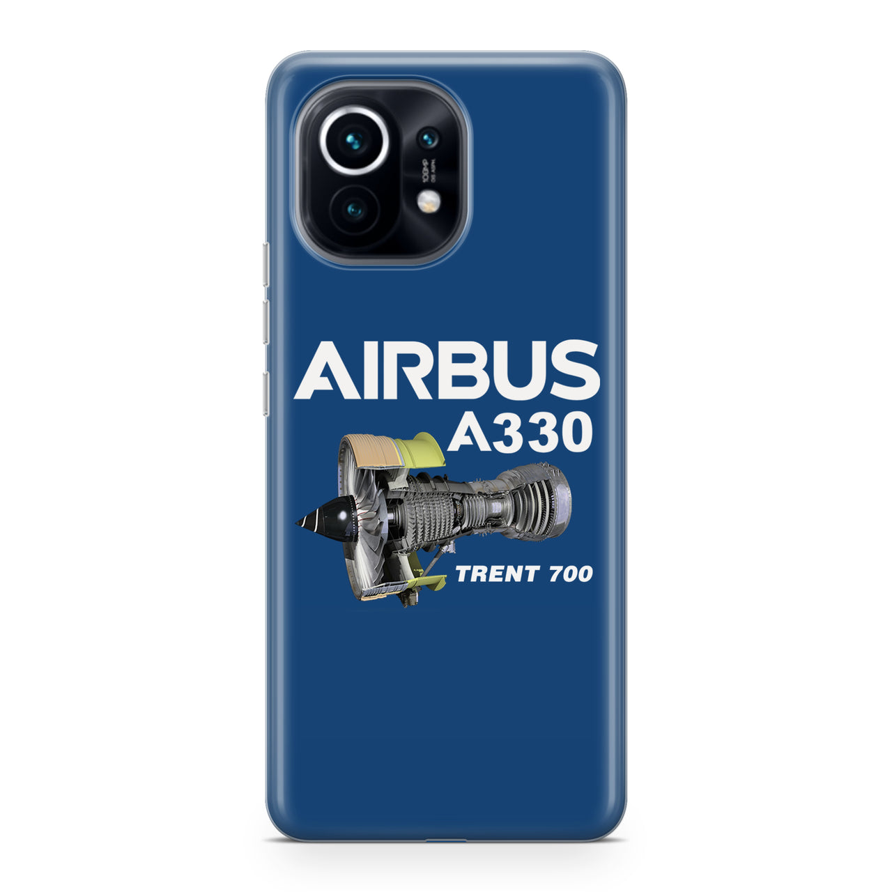 Airbus A330 & Trent 700 Engine Designed Xiaomi Cases