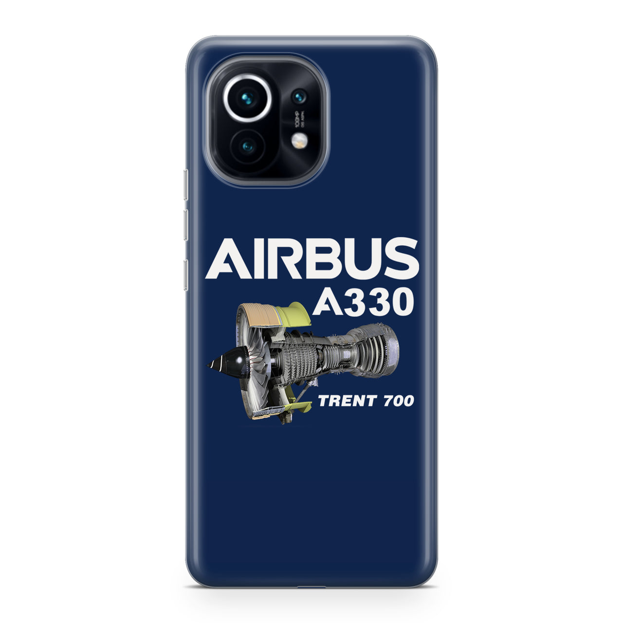 Airbus A330 & Trent 700 Engine Designed Xiaomi Cases