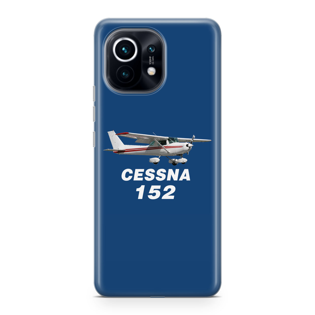 The Cessna 152 Designed Xiaomi Cases