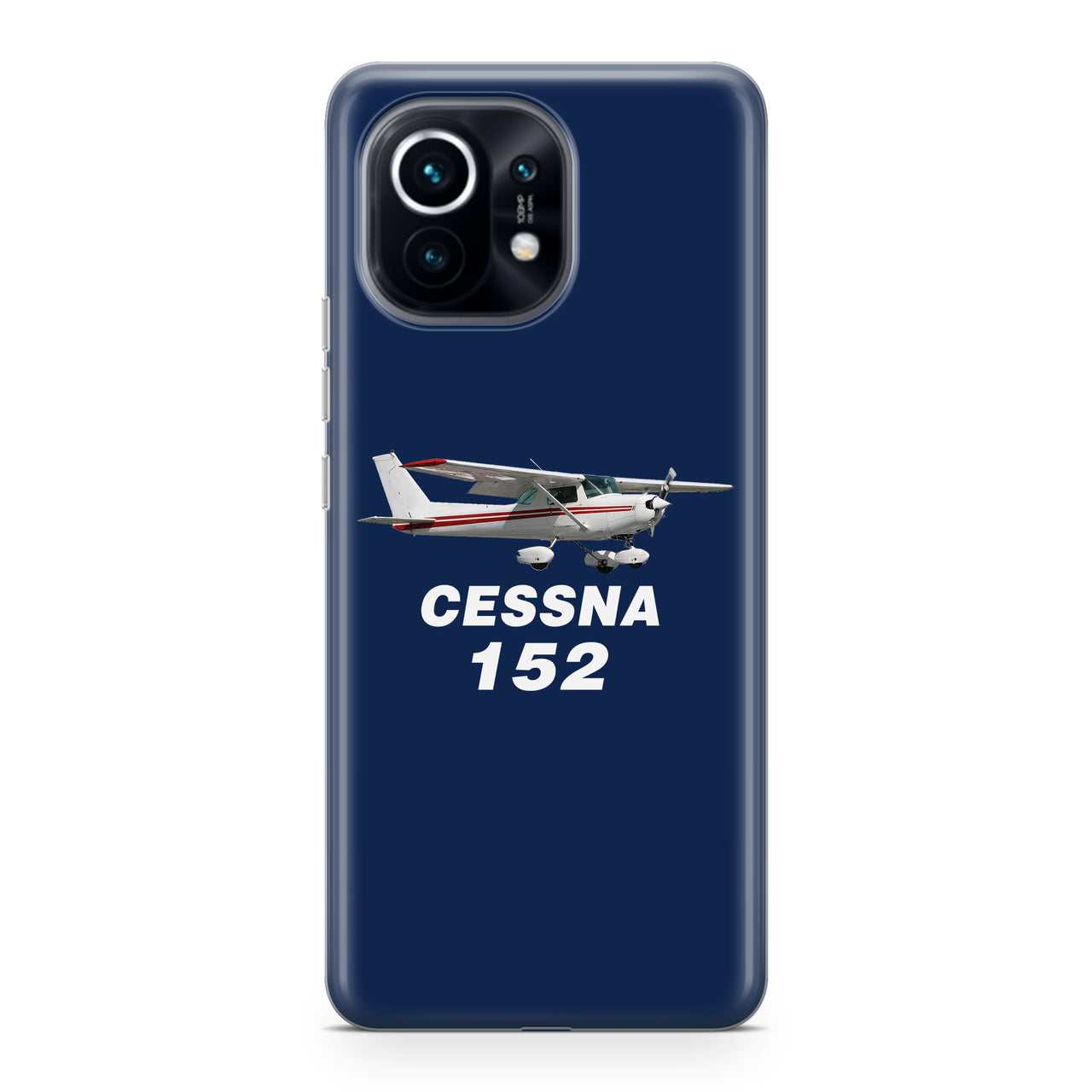 The Cessna 152 Designed Xiaomi Cases