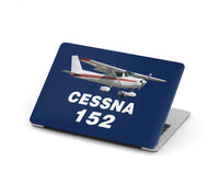 Thumbnail for The Cessna 152 Designed Macbook Cases